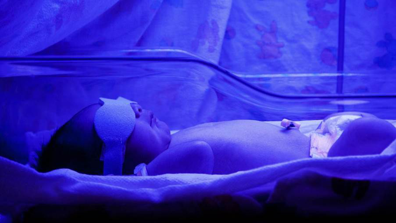 Vàng da tán huyết là gì?