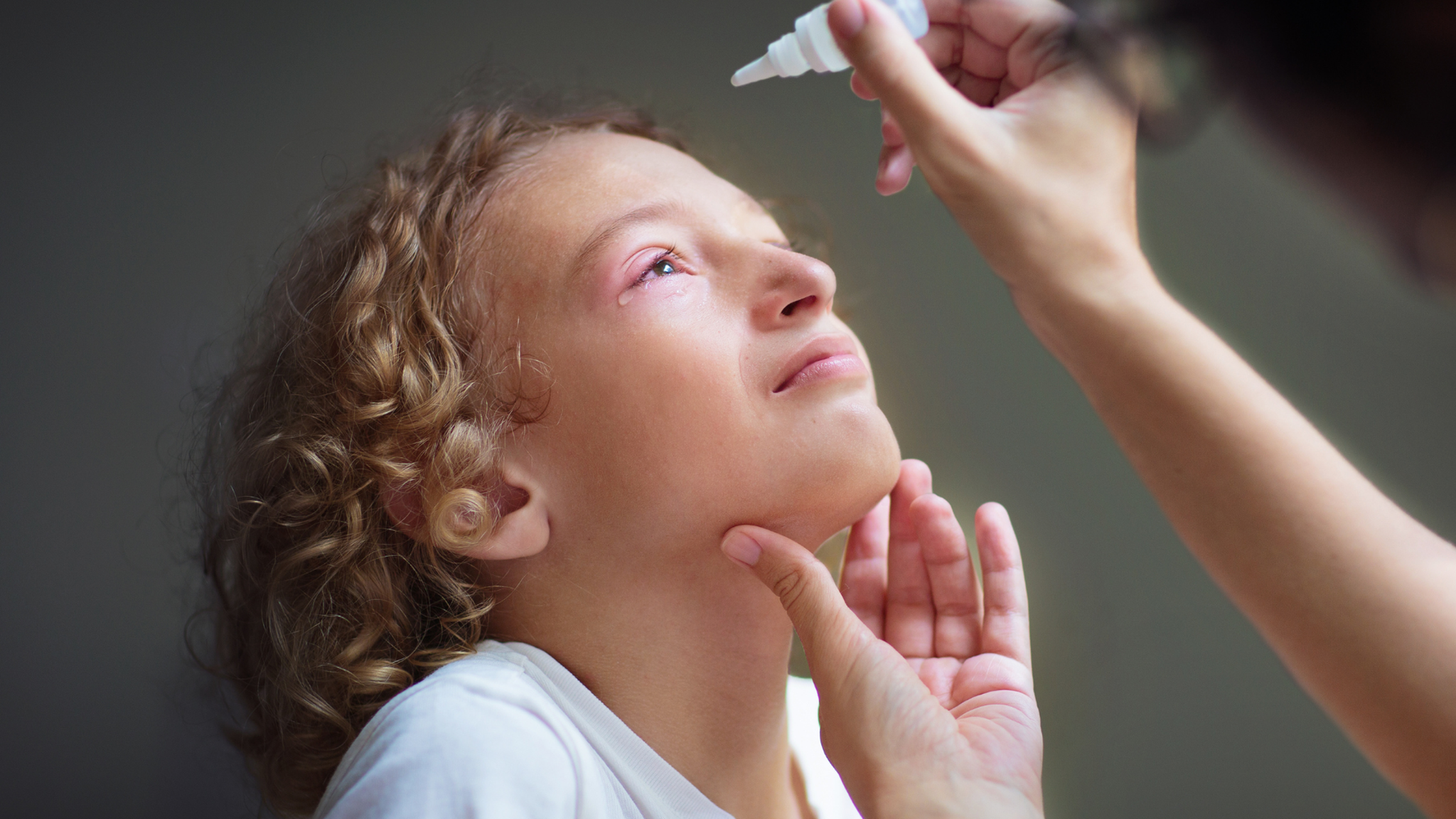 Viêm kết mạc cấp: Nguyên nhân, triệu chứng và điều trị