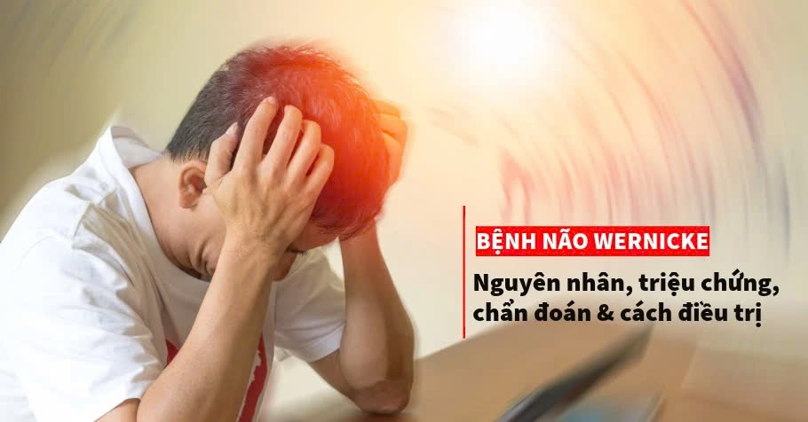 Bệnh não Wernicke là gì? Những điều cần biết về bệnh não Wernicke