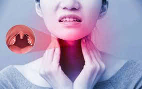Viêm amidan xơ teo: Nguyên nhân, triệu chứng và điều trị