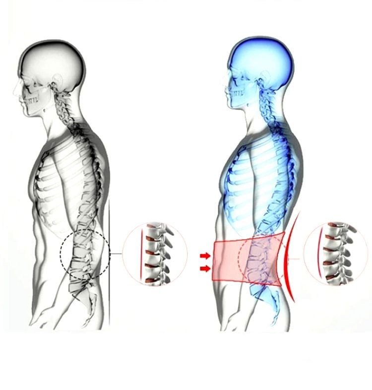 Đai Bảo Vệ Lưng Galvaran