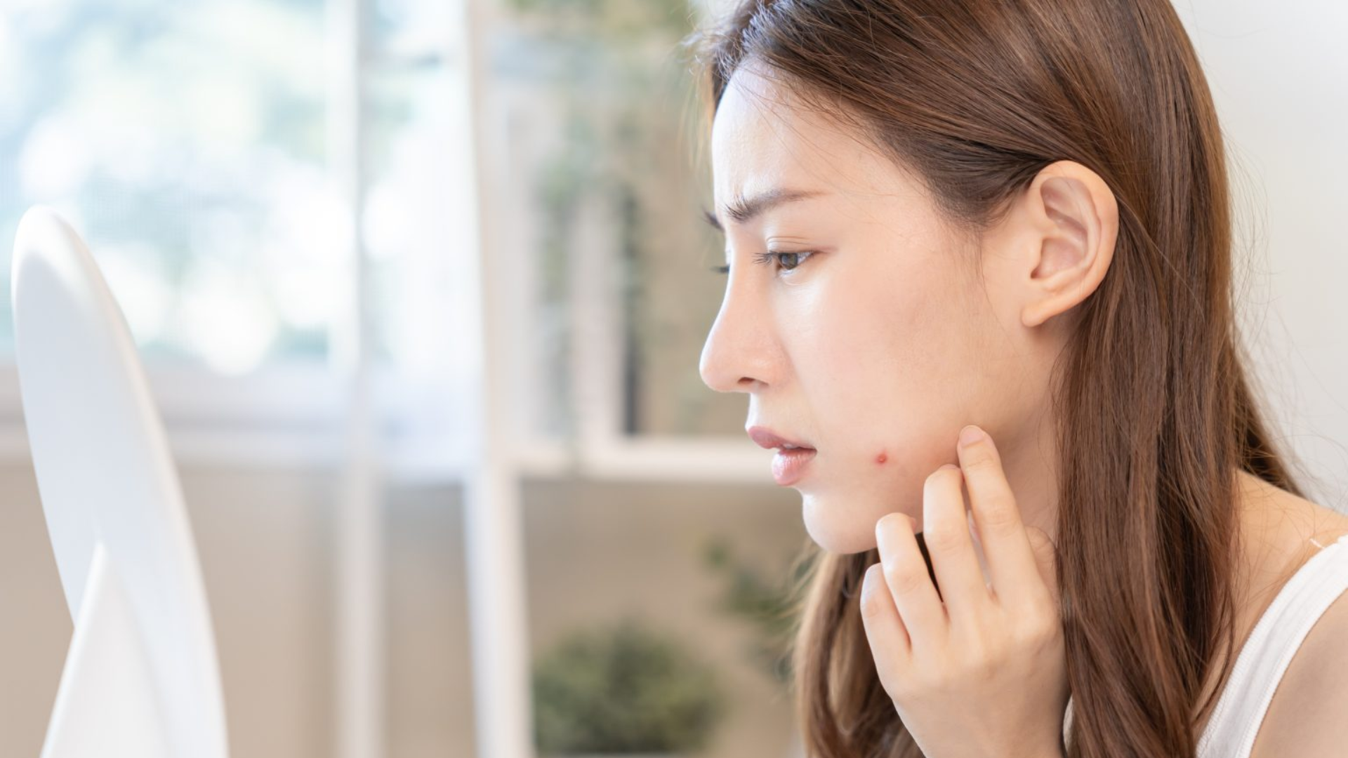 Vì sao mụn quanh hàm không hết? Giới thiệu các phương pháp điều trị và phòng ngừa