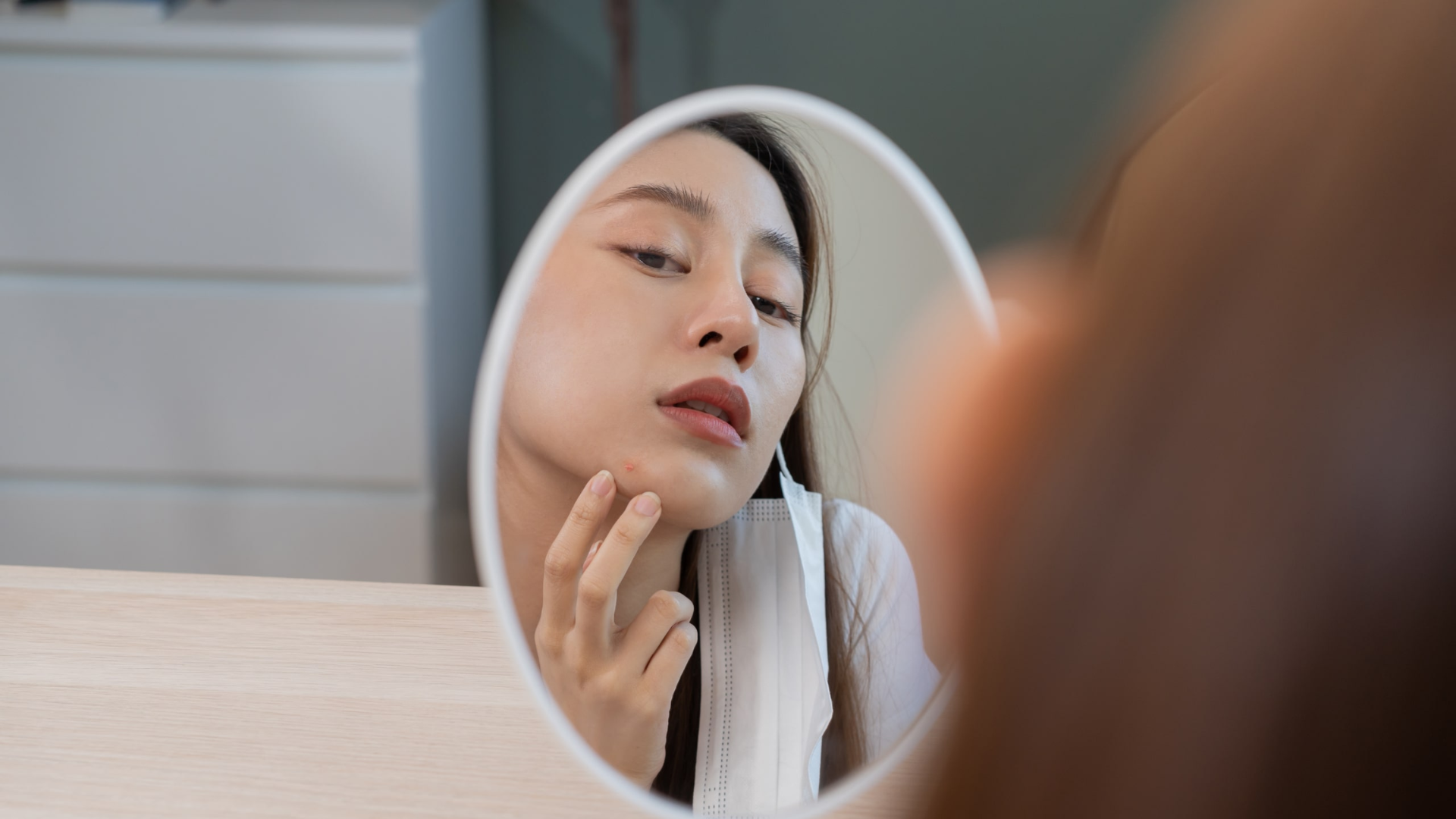 Các loại sẹo mụn và mẹo chăm sóc da bạn nên áp dụng