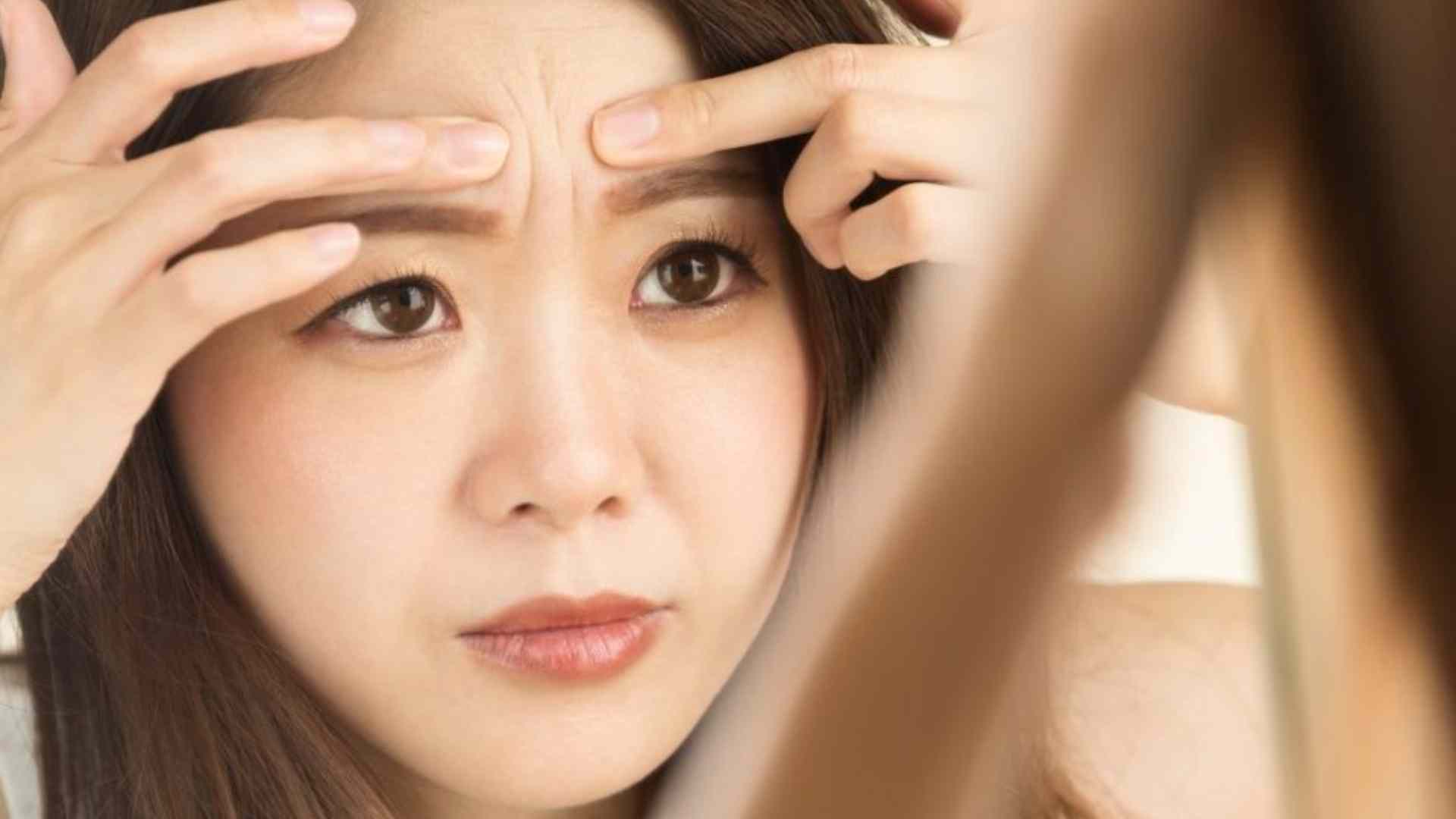 VẾT THÂM MỤN - NGUYÊN NHÂN VÀ CÁCH LOẠI BỎ