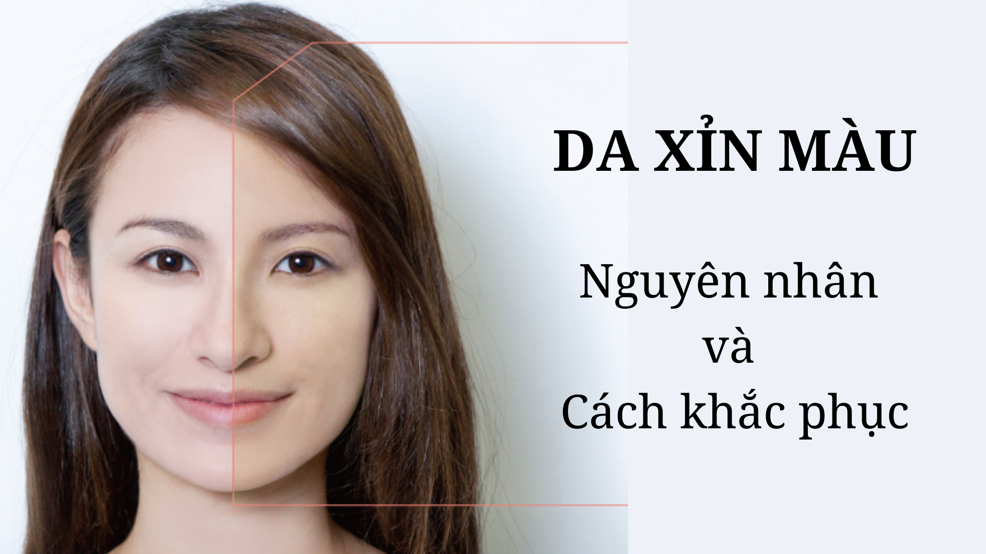 Da Xỉn Màu - Nguyên Nhân Và Cách Cải Thiện