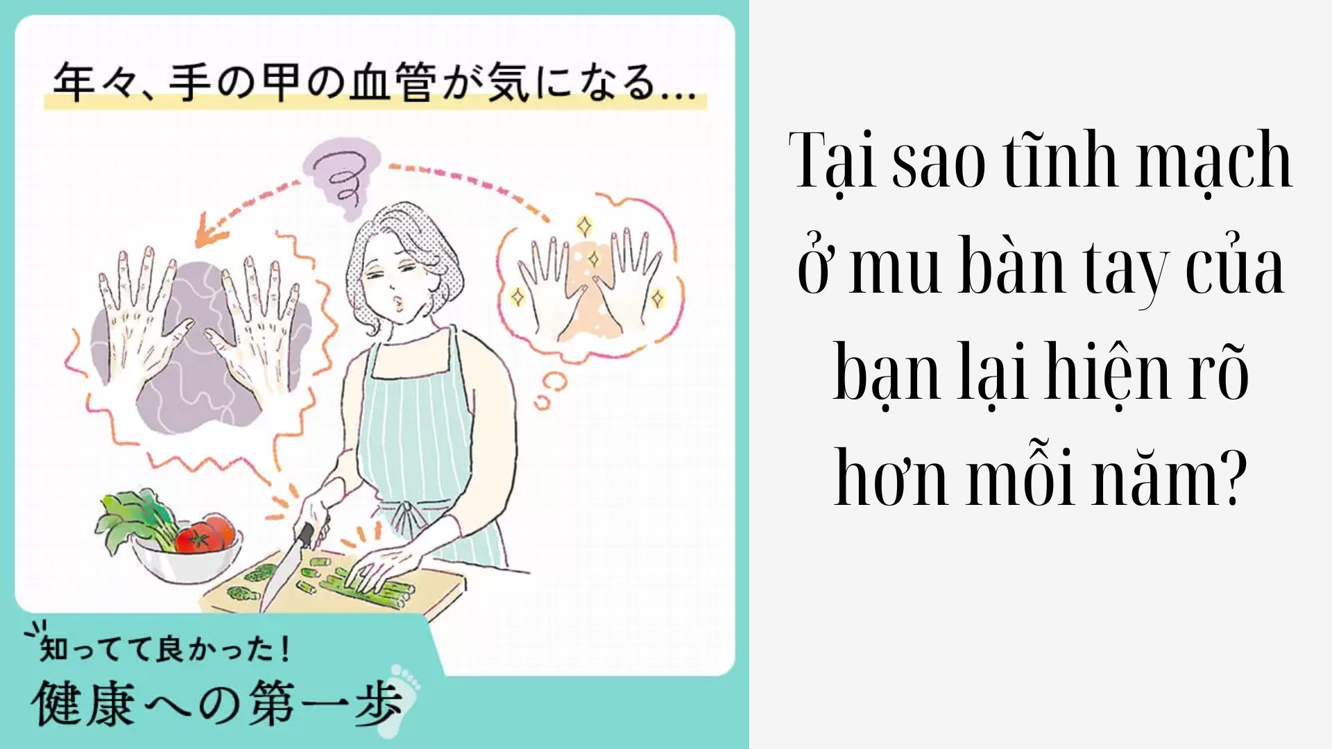 Tại sao tĩnh mạch ở mu bàn tay của bạn lại hiện rõ hơn mỗi năm?
