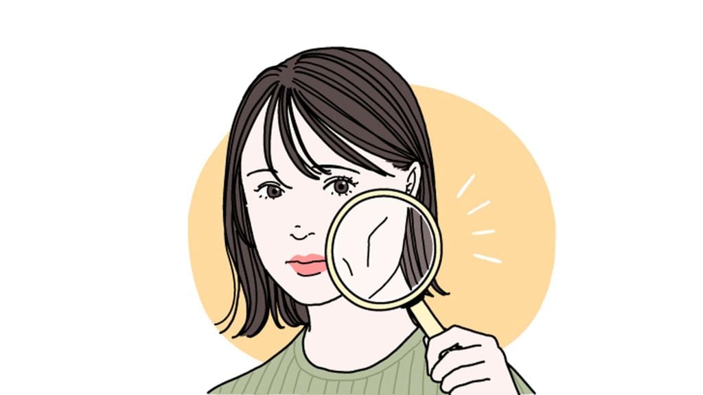 Tại sao má bị chảy xệ?