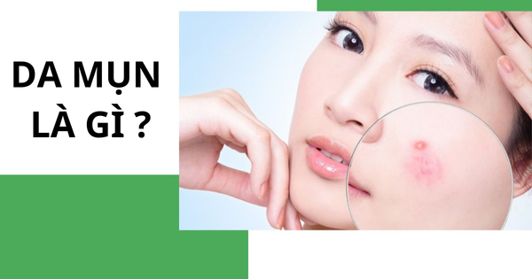 Khám phá Bí Mật: Da Mụn Là Gì ?