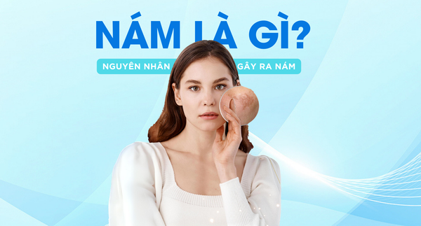 Nám Da Là Gì: Nguyên Nhân Gây Nám Da Cần Biết