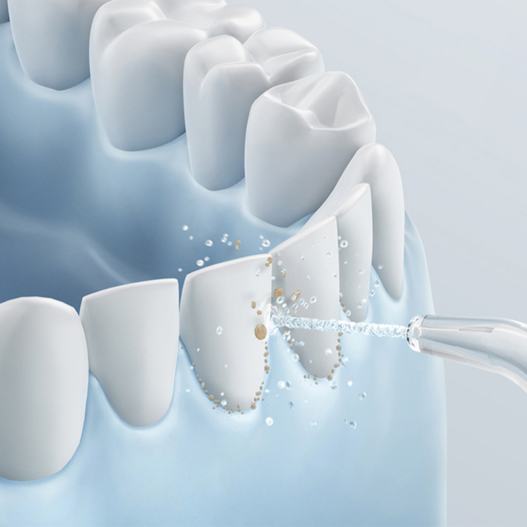 Water Flosser Pocket - 2
