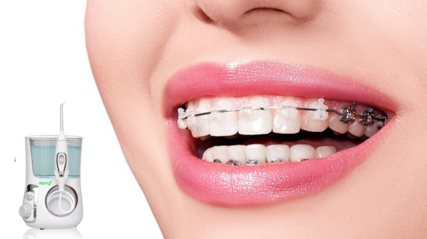 Thực hư tin đồn hàng ngày dùng máy tăm nước gia đình hỏng răng nướu?!