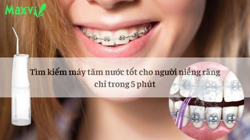 Tìm kiếm máy tăm nước tốt cho người niềng răng chỉ trong 5 phút