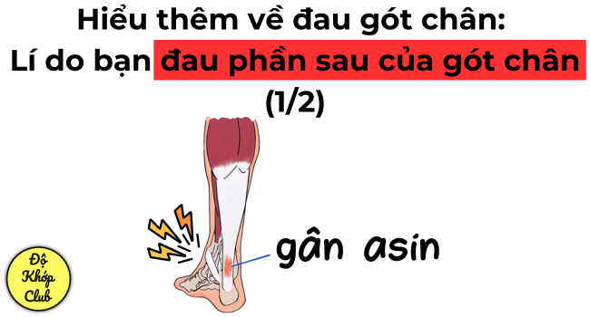 Hiểu thêm về đau gót chân: Lí do bạn đau phần sau của gót (1/2)