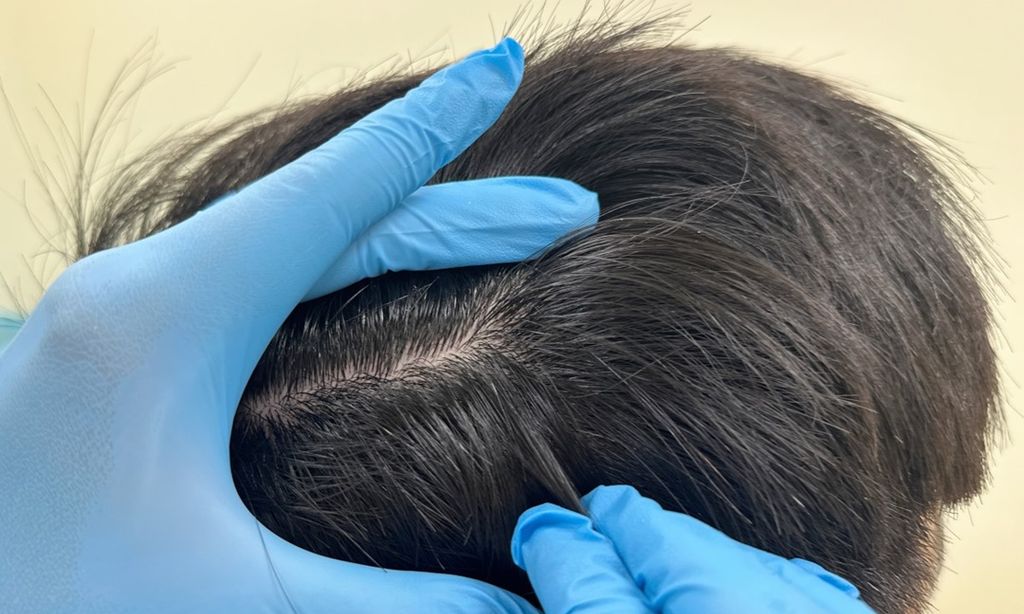 Mỗi sợi tóc đều có cấu trúc gồm 3 lớp