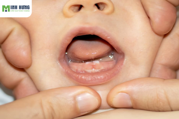 mach-ban-cach-cham-soc-rang-mieng-cho-tre-dung-cach