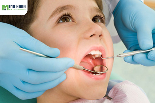 mach-ban-cach-cham-soc-rang-mieng-cho-tre-dung-cach