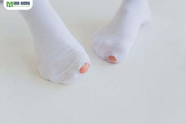 top5-dau-hieu-nhan-biet-thoi-diem-thay-tat-nam-thich-hop