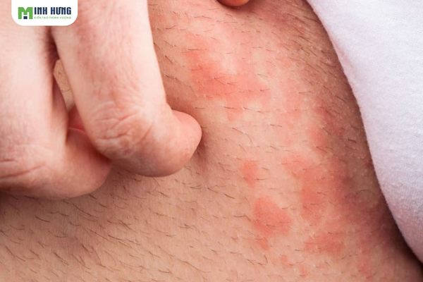 nam-gioi-co-nen-mac-quan-lot-khi-ngu-bao-ve-suc-khoe-nam-gioi