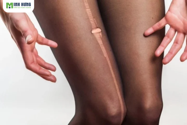 bo-tui-top4-cach-dien-quan-tat-dep-ma-khong-phan-cam-ngay-tet-