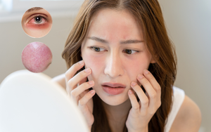 Kem Dưỡng Lành Tính Cho Da Mỏng Yếu: Bí Quyết Chăm Sóc Da Hoàn Hảo