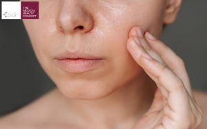 Da Đổ Dầu Thiếu Ẩm Bí Mật Ít Ai Biết