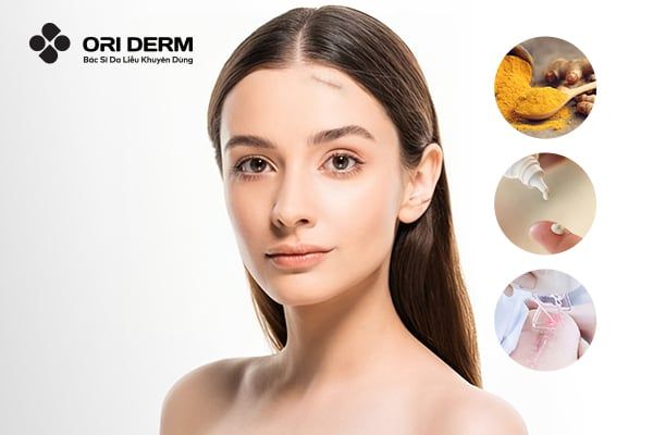 5 Cách Làm Mờ Sẹo Sau Phẫu Thuật Hiệu Quả Mà Bạn Nên Thử