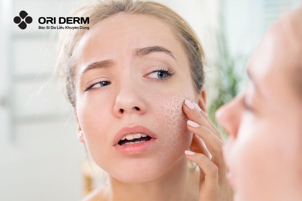 Tại sao nên dùng kem dưỡng ẩm cho da khô?