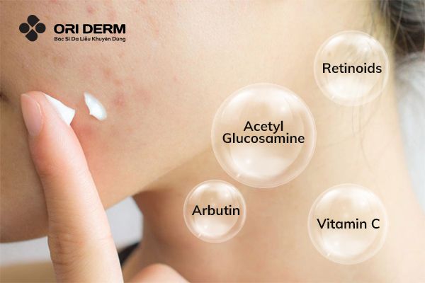 Cách chọn kem trị thâm mụn hiệu quả và an toàn cho làn da