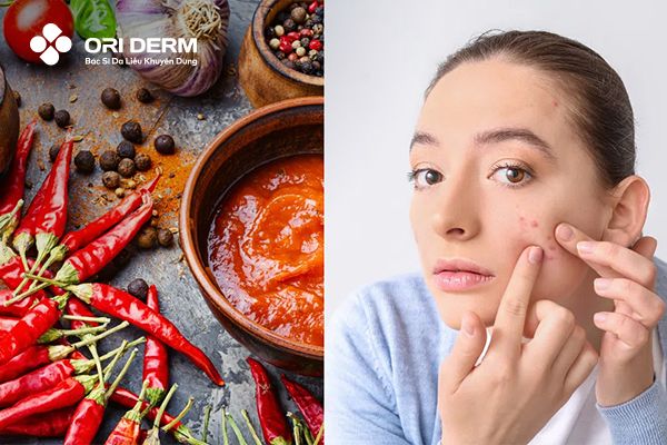 Lưu ý cần nhớ khi dùng kem dưỡng ẩm và kem trị mụn