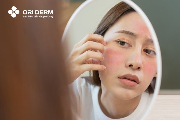 Biểu hiện của làn da khi cần ngừng sử dụng retinol