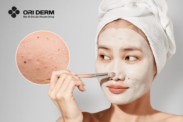 Bật mí 10 Công Thức Làm Mặt Nạ Trị Mụn Đầu Đen Hiệu Quả Tại Nhà