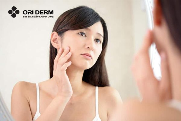 Phương pháp dùng nước muối sinh lý trị mụn có tốt không?