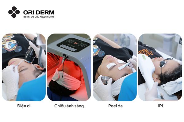 Trị thâm mụn bằng phương pháp Y khoa