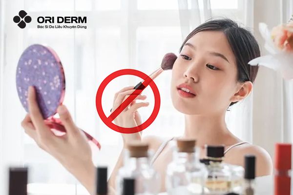 Những lưu ý giúp&nbsp;ngăn ngừa mụn viêm hiệu quả