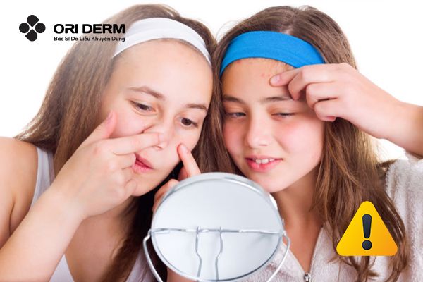 Tip hay giúp cải thiện tình trạng mụn tuổi dậy thì hiệu quả