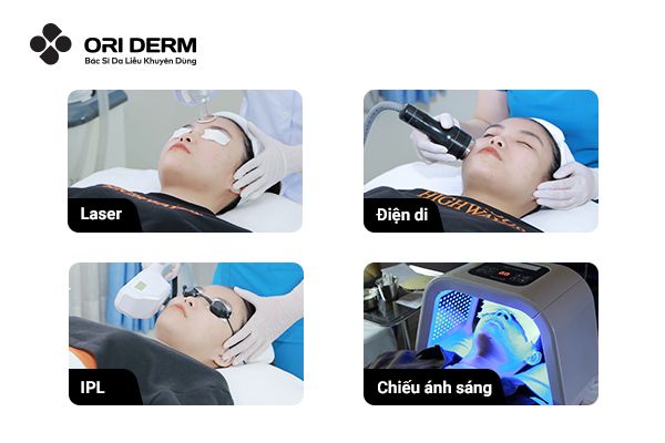 Điều trị vết thâm mụn bằng phương pháp Y Khoa