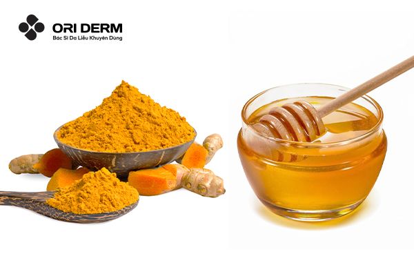 Mặt nạ trị mụn tại nhà với nghệ và mật ong