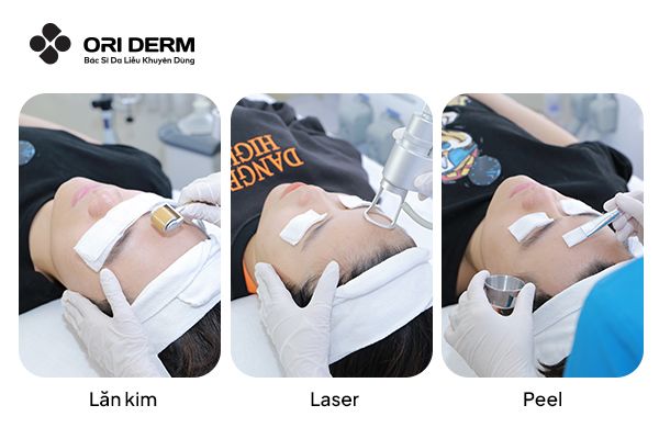 Làm mờ sẹo thâm bằng phương pháp Y khoa