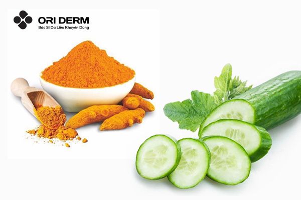 Trị mụn thâm bằng dưa chuột và bột nghệ