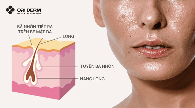Sợi bã nhờn