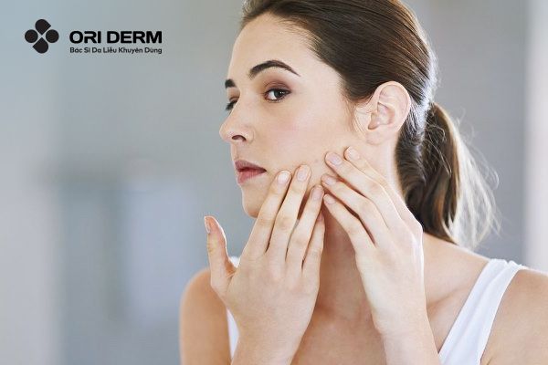 Lưu ý khi chăm sóc da giúp ngăn ngừa mụn hiệu quả