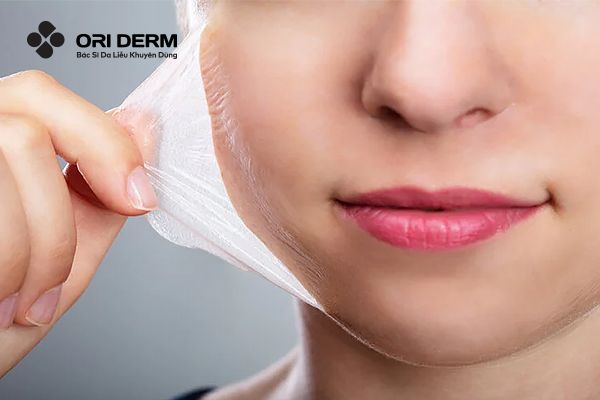 Peel da là gì? Vì sao peel da được ưa chuộng?