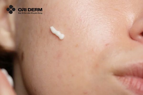 Ai nên sử dụng Retinol?