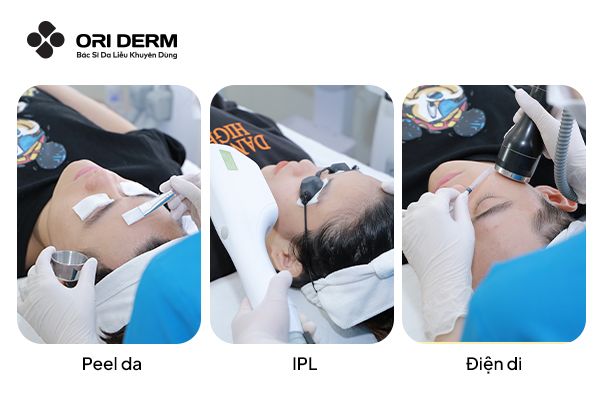 Trị thâm đỏ sau mụn bằng phương pháp Y khoa