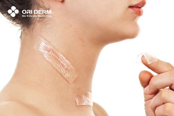 Cách làm mờ sẹo sau phẫu thuật bằng silicone y tế