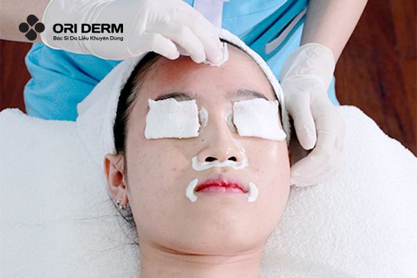 Bước 1: Làm sạch da và bảo vệ vùng da nhạy cảm