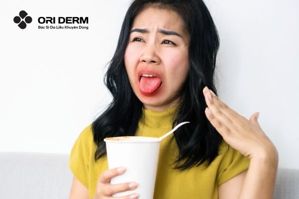 Ăn cay có nổi mụn không?