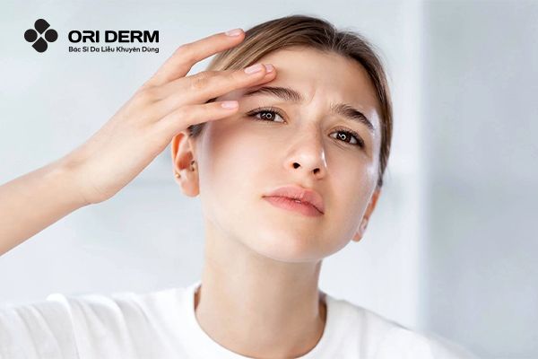 Vì sao cần trang điểm đúng cách cho da mụn?