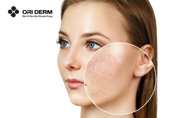 Vì sao nên tẩy tế bào chết chết cho da?