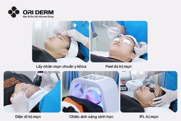 Các phương pháp chăm sóc da mụn chuyên sâu tại các cơ sở Y&nbsp;khoa
